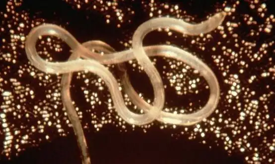 Loa loa is the filarial nematode species that causes loa loa filariasis
