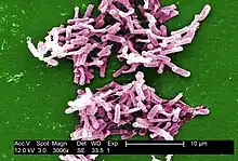 Magnification of 3006X, digitally-colorized scanning electron microscopic (SEM) image of a large grouping of rod-shaped, Gram-positive Clostridium difficile bacteria.