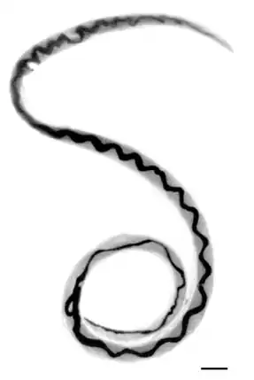 Adult female worm of "Angiostrongylus cantonensis" with characteristic barber-pole appearance (anterior end of worm is to the top). Scale bar is 1 mm.