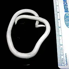 Ascaris lumbricoides adult worms (with measuring tape for scale)