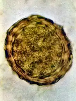 Fertile egg in human faeces (detail)