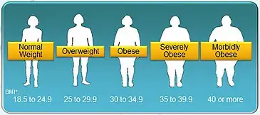 A chart showing BMI classification for obesity and overweight. Overweight or obese mothers have a higher risk of experiencing DOL.