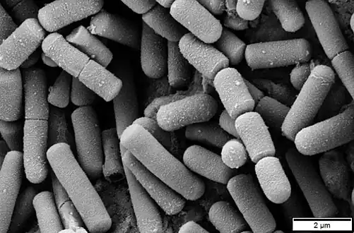 Electron micrograph of Bacillus cereus