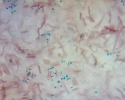 Bacillus cereus endospore stain