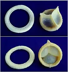 A replaceable model of Cardiac Biological Valve Prosthesis.