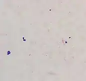 A few large, spherical, purple bacteria in small clusters on a faded pink background