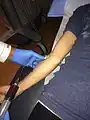 Blood drawn from patient