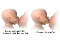Breastfeeding – Incorrect vs correct latch-on.