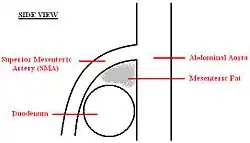 A diagram of a healthy mesenteric angle.