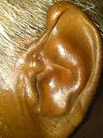 A cauliflower ear deformity