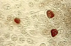 Chlamydia trachomatis inclusion bodies (brown) in a McCoy cell culture