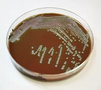 Chocolate agar culture showing Francisella tularensis colonies