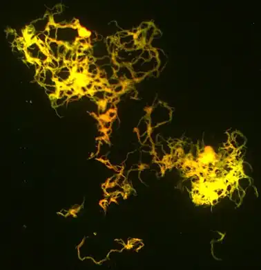Cording M. tuberculosis (H37Rv strain) culture on the luminescent microscopy