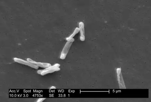 Individual, drumstick-shaped C. difficile bacilli seen through scanning electron microscopy