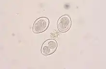 Coccidia oocysts in a fecal flotation from a cat. The cat was underweight and had diarrhea, showing signs of coccidiosis