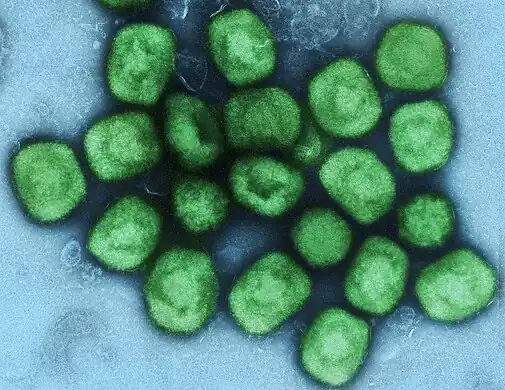 Colorized transmission electron micrograph of mpox virus particles (green)