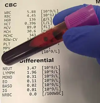 Blood samples that have been drawn