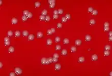 "Corynebacterium ulcerans" colonies on a blood agar plate