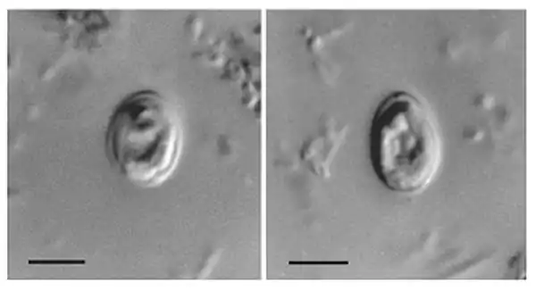 Nomarski interference contrast photomicrographs of Cryptosporidium muris from the feces of an HIV-positive human