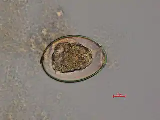 Diphyllobothrium latum - fertilized egg
