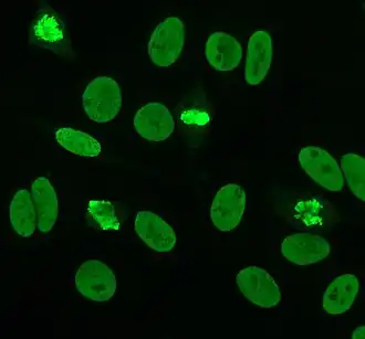 Picture of immunofluorescence staining pattern of dsDNA antibodies.