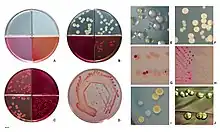 E. coli colonies