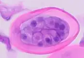 Cross-section of early E. vermicularis egg, H&E stain