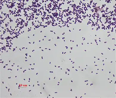 This is a Gram stain for Enterococcus faecalis under 1000 magnification (bright field microscopy)