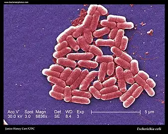 SEM -Escherichia coli (strain O157:H7).