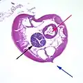 Micrograph of male pinworm in cross section, alae (blue arrow), intestine (red arrow) and testis (black arrow), H&E stain