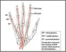 A drawing of the hand and tendons.