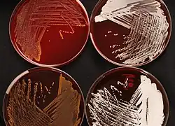 Four different Nocardia species on sheep blood agar demonstrating different colouring