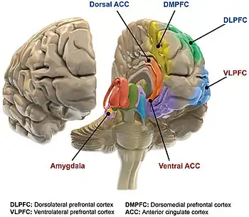 An image showing areas of the brain affected by bipolar disorder.