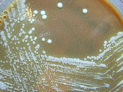 F. tularensis colonies on an agar plate