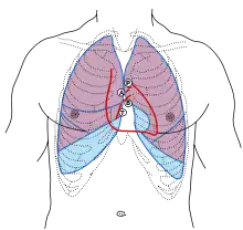 Front of thorax, showing surface relations of bones, lungs (purple), pleura (blue), and heart (red outline). Heart valves are labeled with "B", "T", "A", and "P".