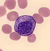 Immature granulocyte (myelocyte)