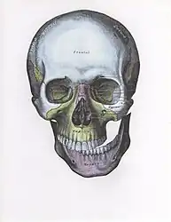 Front view of the skull with lateral dislocation of jaw.