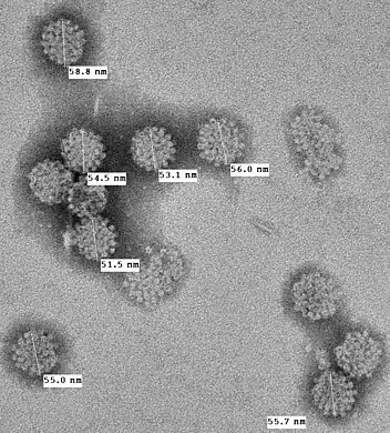 Electron microphotograph (x50,000) of MCV capsids artificially produced as virus-like particles by expressing MCV structural proteins in cells. The 55–60 nm viral capsids have typical icosahedral symmetry found in polyomaviruses.