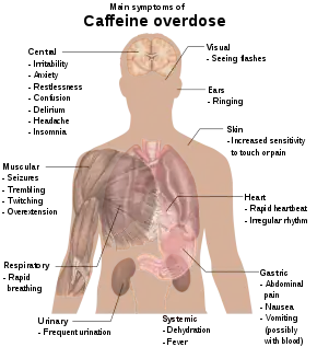 Torso of a young man with overlaid text of main side-effects of caffeine overdose.