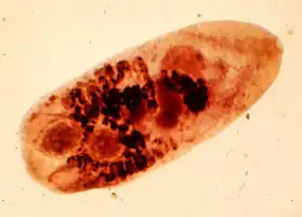 "Metagonimus yokogawai" specimen