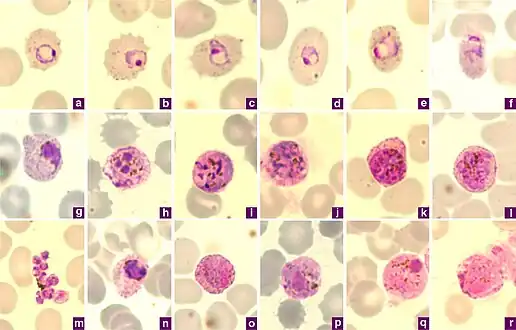 Microphotographs of Plasmodium ovale in Giemsa-stained thin blood films. a–c ring stages, d, e young trophozoites, f trophozoite, g late trophozoite, h young schizont, i–k growing schizont, l late schizont, m ruptured schizont, n young gametocyte, o, p developing macrogametocytes, q macrogametocyte, r microgametocyte.