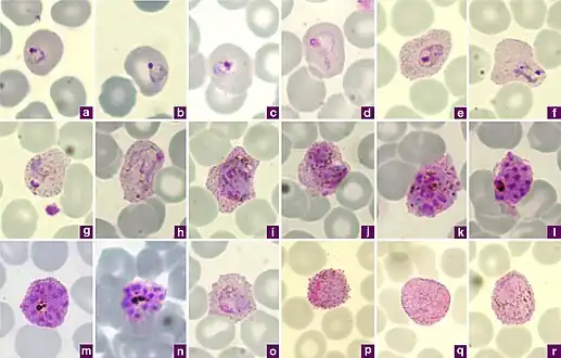 Microphotographs of Plasmodium vivax in Giemsa-stained thin blood films. a, b ring stages, c–e young trophozoites, f–h amoeboid trophozoites, i young schizont, j–l growing schizonts, m developed schizont, n mature schizont, o young gametocyte, p macroga‑metocyte, r, q microgametocytes.