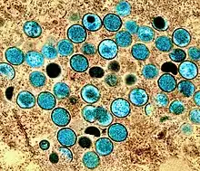 Electron micrograph of mpox virus