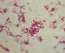 bacteria growth in red on white background