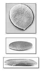 Multiple views of a Neisseria gonorrhoeae bacterium, which causes gonorrhea