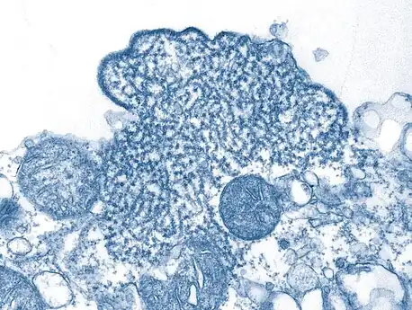 Transmission electron micrograph (TEM) depicted a number of Nipah virus virions from a person's cerebrospinal fluid