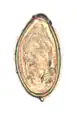 An egg of O. viverrini. 400× magnification.
