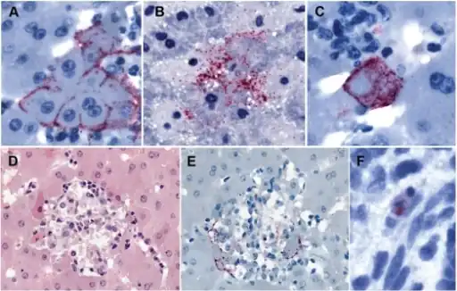 a-f)Immunohistochemical localization of Marburg virus antigens in Roussetus aegypticus tissues
