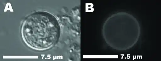 a,b)Unsporulated oocyst of Cyclospora cayetanensis in an unstained stool preparation