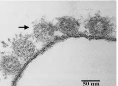 Thin-section electron micrograph of severe acute respiratory syndrome-associated coronavirus